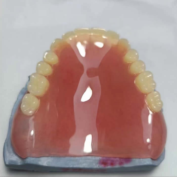 Acrylic Denture 01