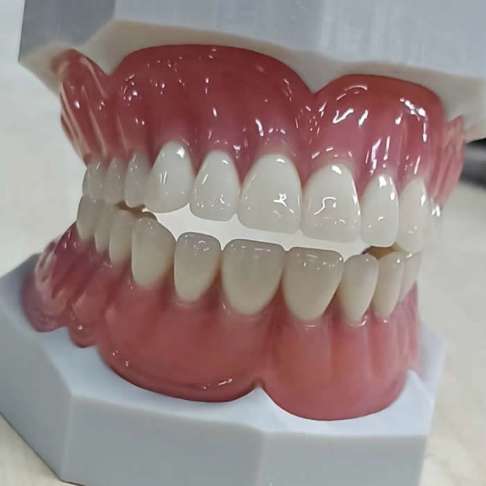 Acrylic Denture 02