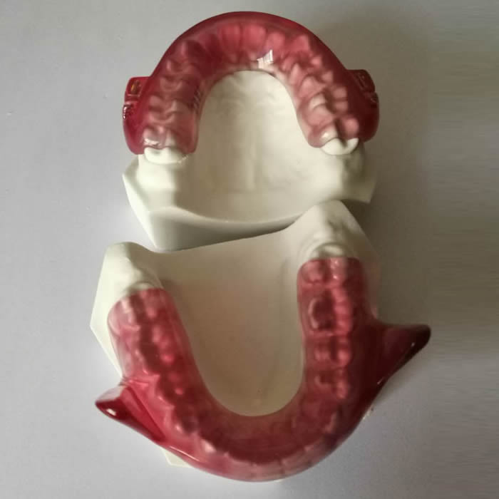 Orthodontic 05