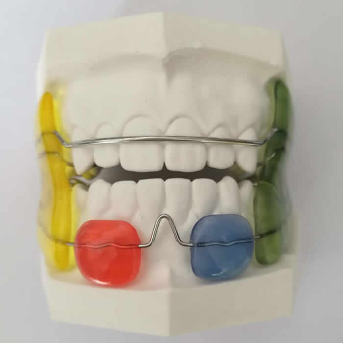 Orthodontic 01