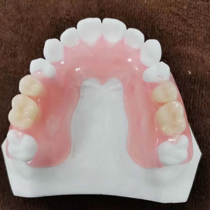 Valplast denture 03