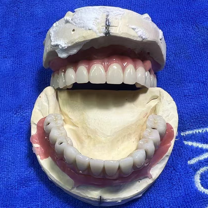 Zirconia Implant 04