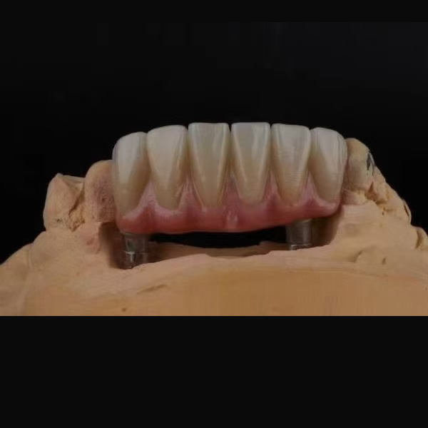 Zirconia Implant 03