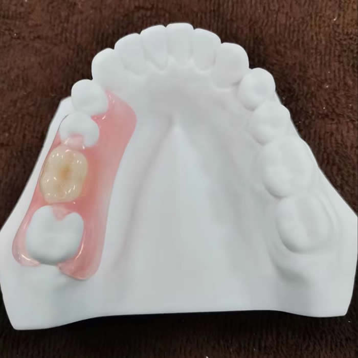 Valplast denture 02