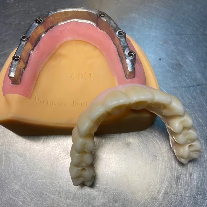 Zirconia Implant 01