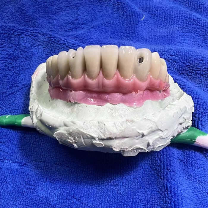 Zirconia Implant 07