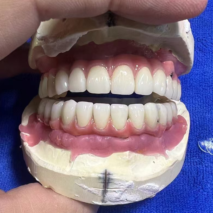 Zirconia Implant 05