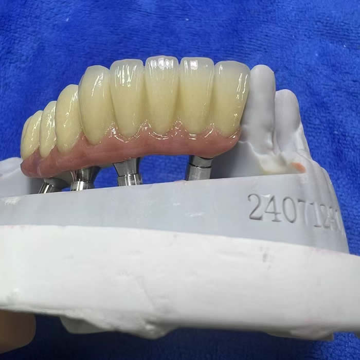 Zirconia Implant 09