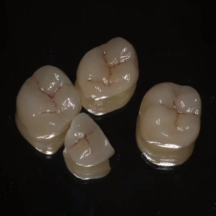 Layered zirconia 01