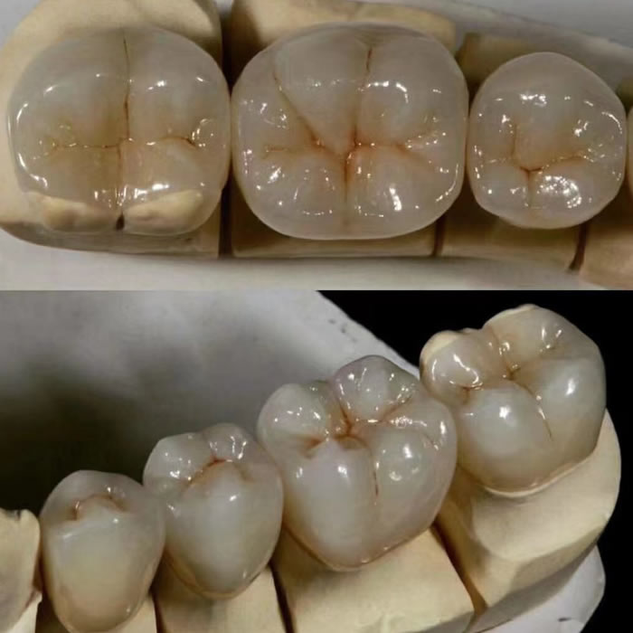 Layered zirconia 02